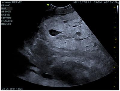 Case Report: Severe Anemia Associated With an Abomasal Fibrosarcoma in a Goat